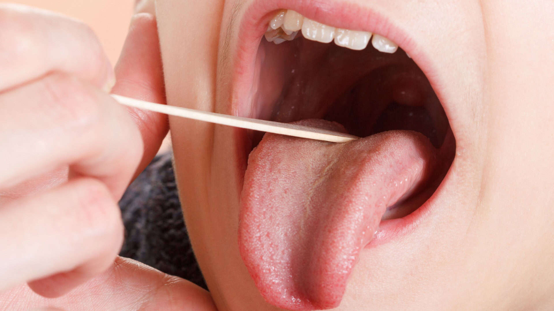 Médico examinando a boca e língua