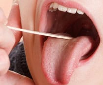 Médico examinando a boca e língua