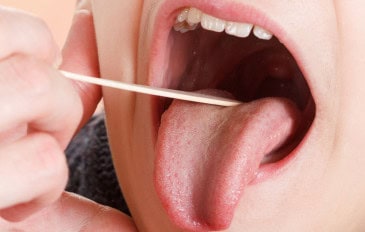 Médico examinando a boca e língua