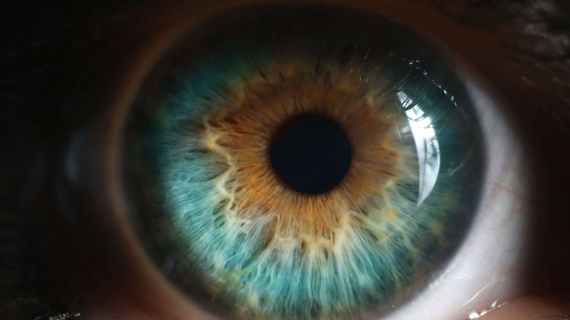 Implante retinal protético devolve visão parcial a pacientes com degeneração macular