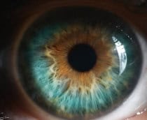 Implante retinal protético devolve visão parcial a pacientes com degeneração macular