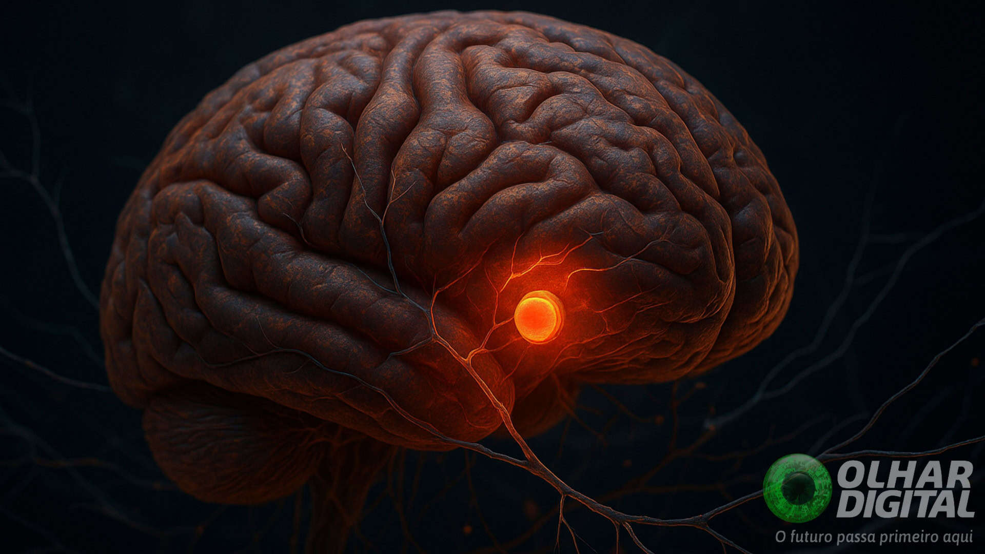 Ilustração de cérebro com botão de dor aceso