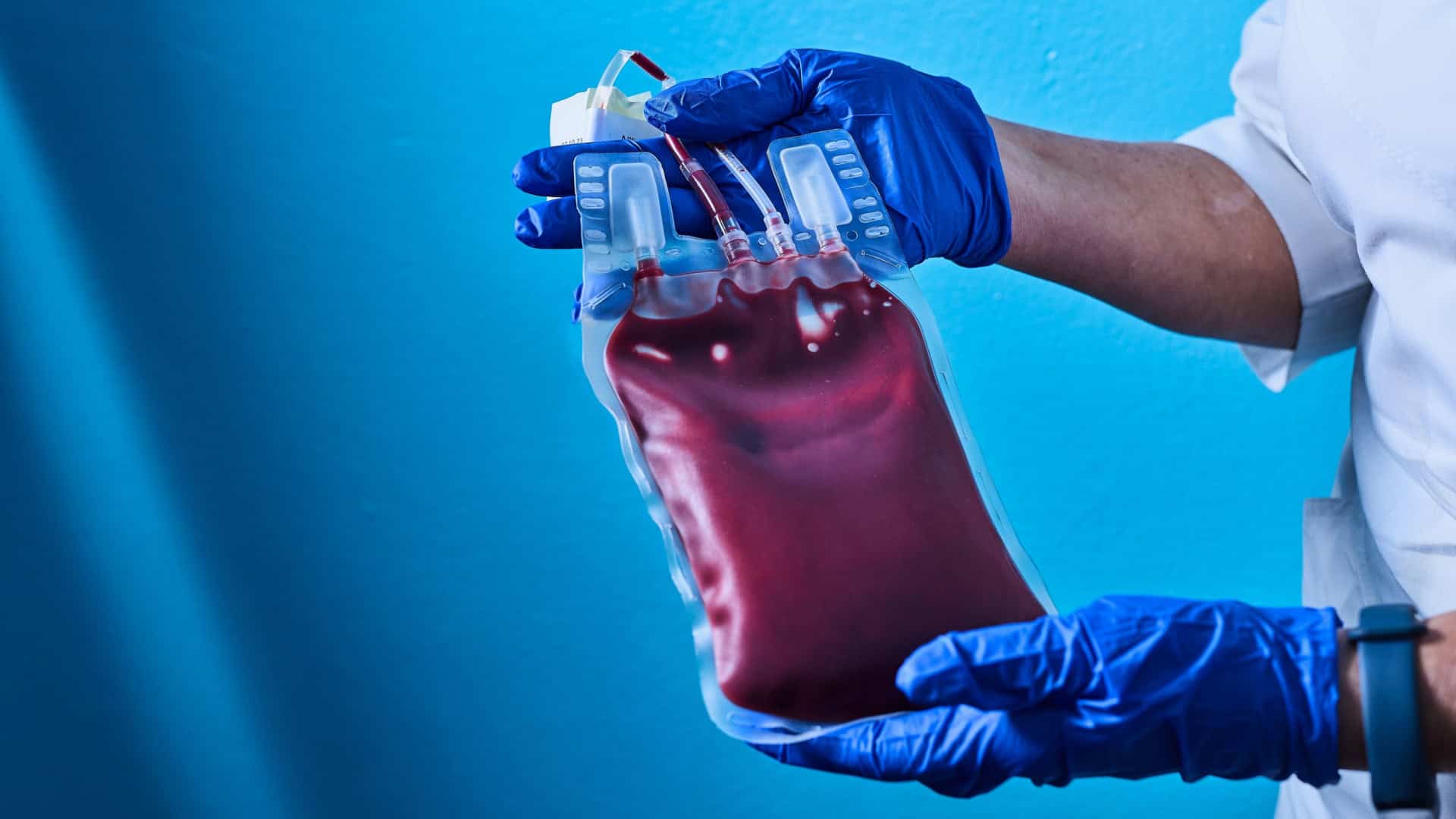 Sangue raro: cientistas tentam criar o tipo Rh nulo em laboratório