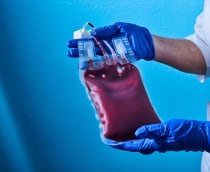 Sangue raro: cientistas tentam criar o tipo Rh nulo em laboratório