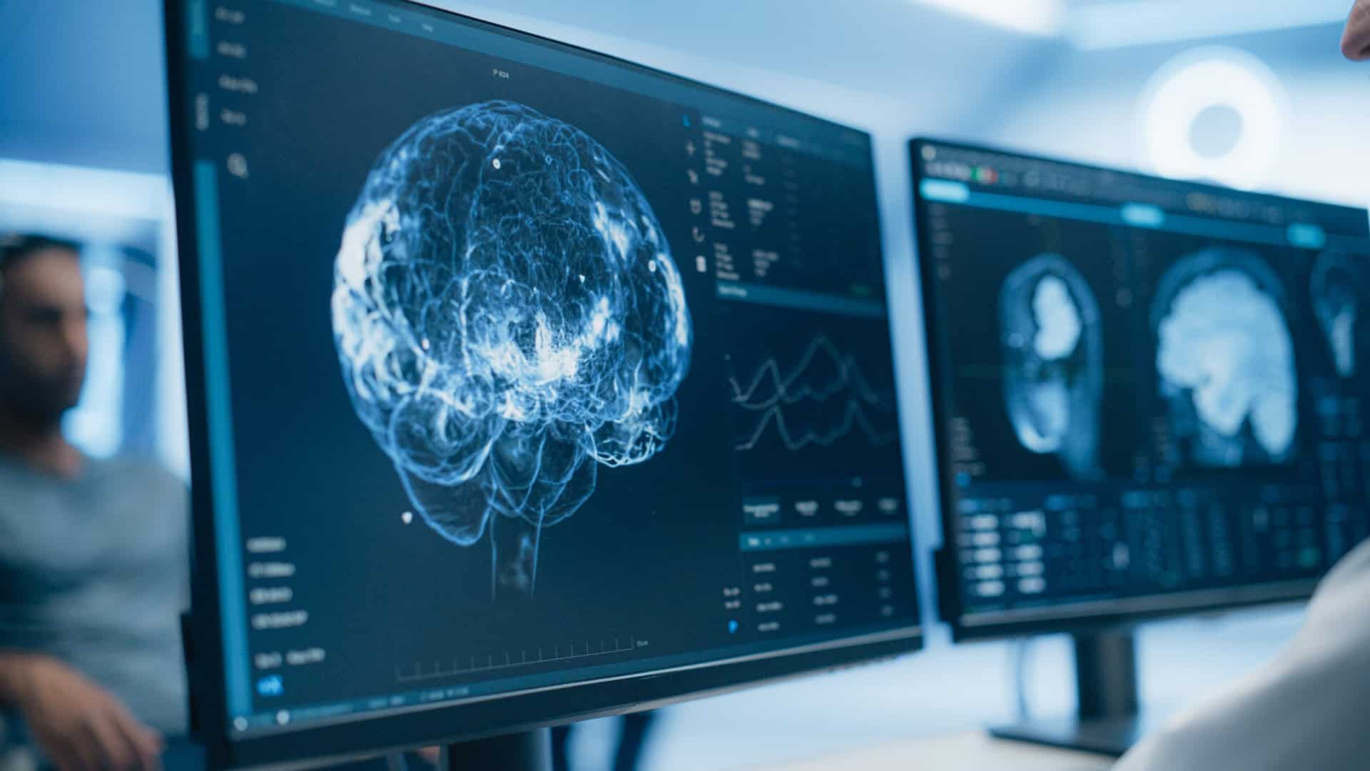 Mapas inéditos mostram que o cérebro humano segue em formação após o nascimento