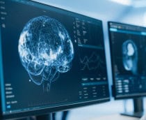 Mapas inéditos mostram que o cérebro humano segue em formação após o nascimento