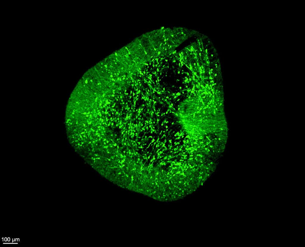 Neurônios dopaminérgicos do mesencéfalo sob um microscópio