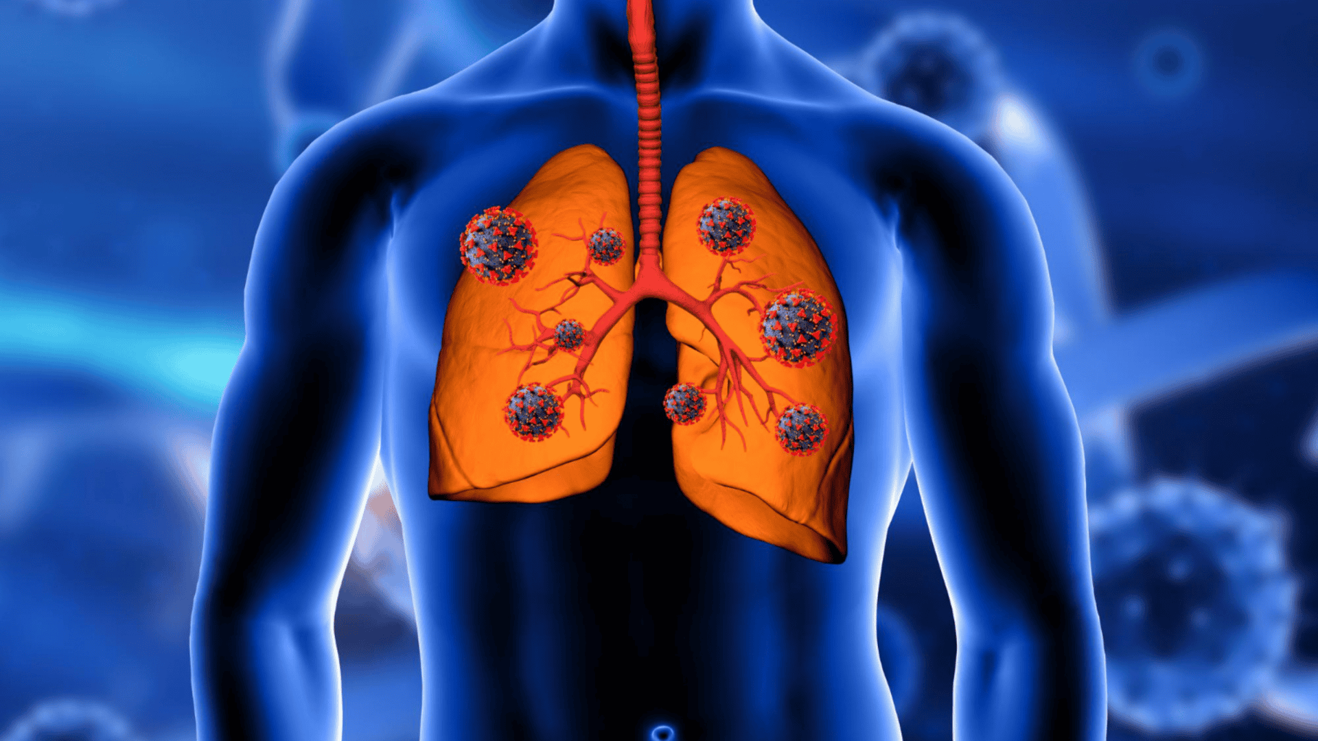 ilustração em 3D mostrando uma pessoa em azul, com os pulmões em destaque na cor laranja e pequenas esferas simbolizando doenças