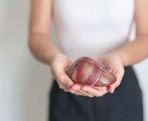 transplante-figado-shutterstock_2468047923-210x172