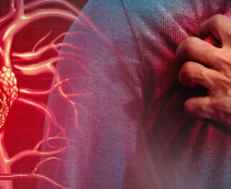 Problema-cardiaco-210x172