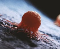 Estudo revela enzima que inicia caos cromossômico ligado ao câncer