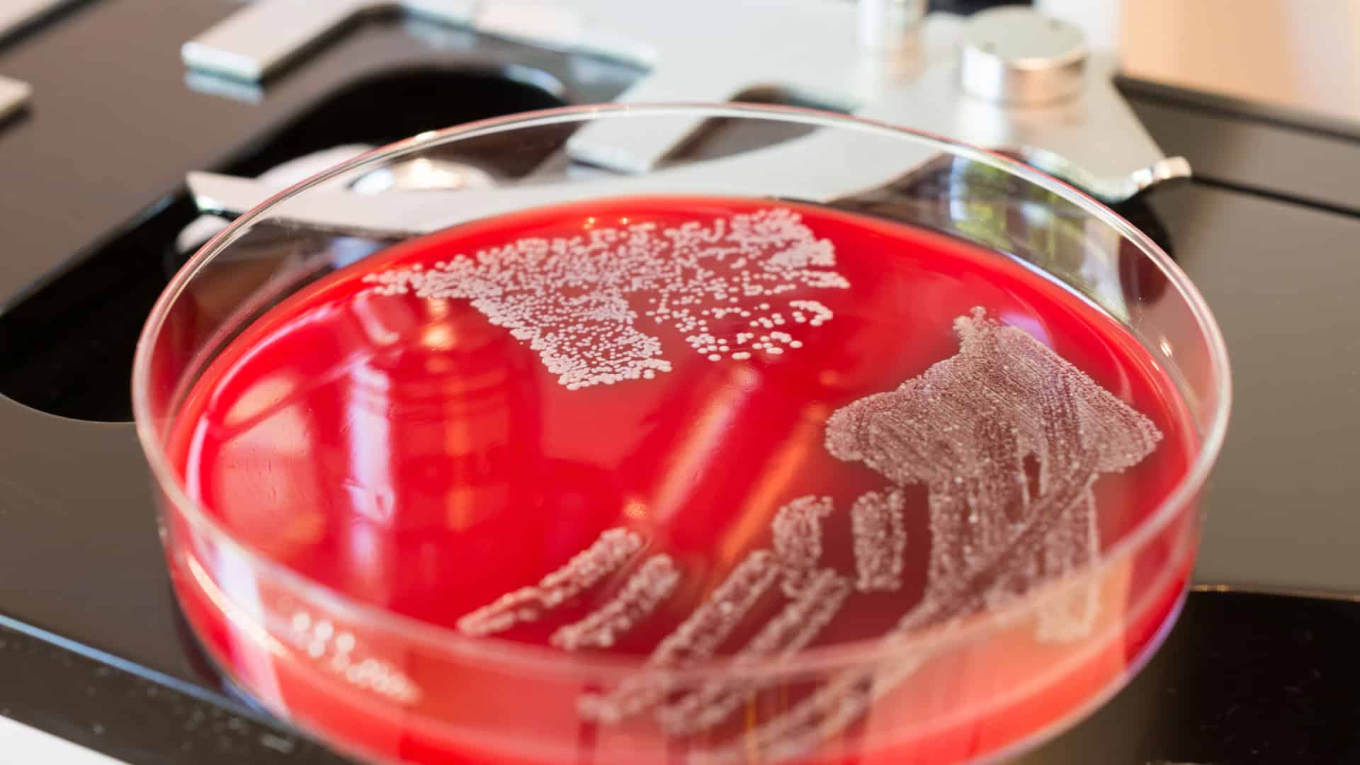 Enzima desmonta proteção de bactéria resistente e aumenta ação de antibióticos