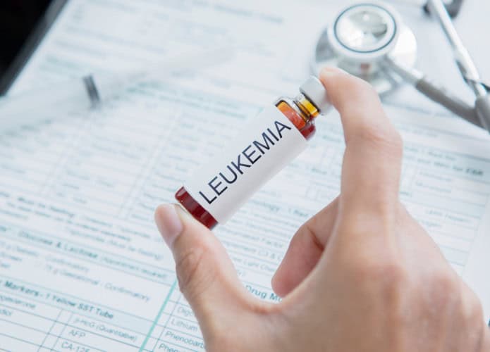 Tratamento experimental de leucemia alcança remissão em 7 de 11 pacientes
