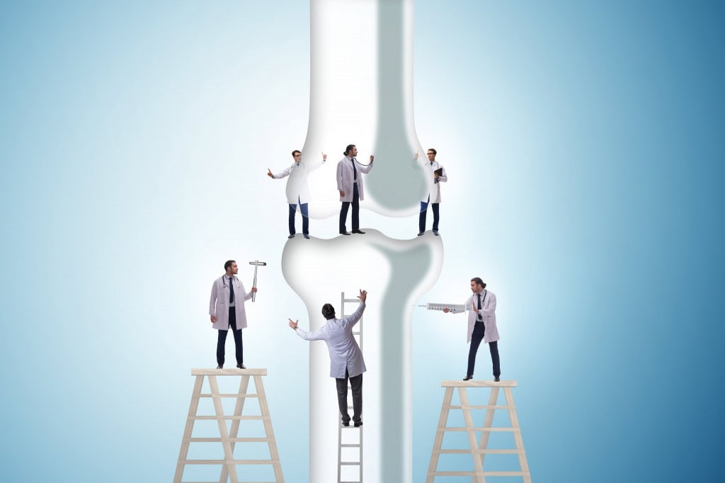 Várias pessoas vestidas com jalecos brancos em cima de escadas e reconstruindo a representação de um osso gigante