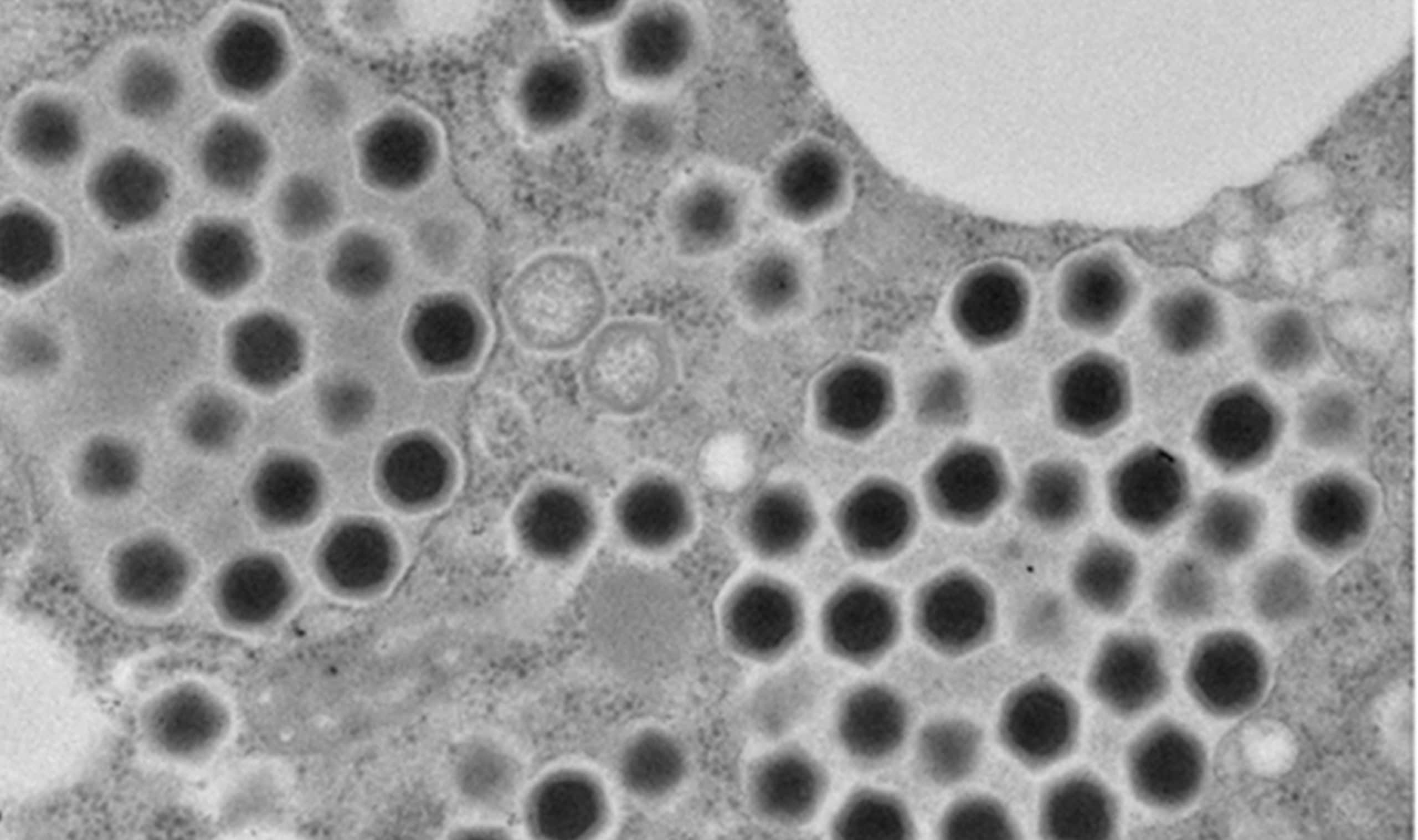 V&iacute;rus gigante rec&eacute;m-descoberto d&aacute; dicas sobre a origem da vida - Olhar  Digital