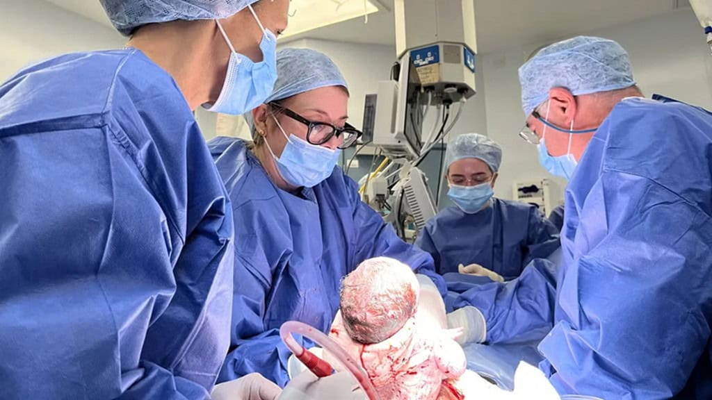 parto do primeiro bebê nascido após transplante de útero