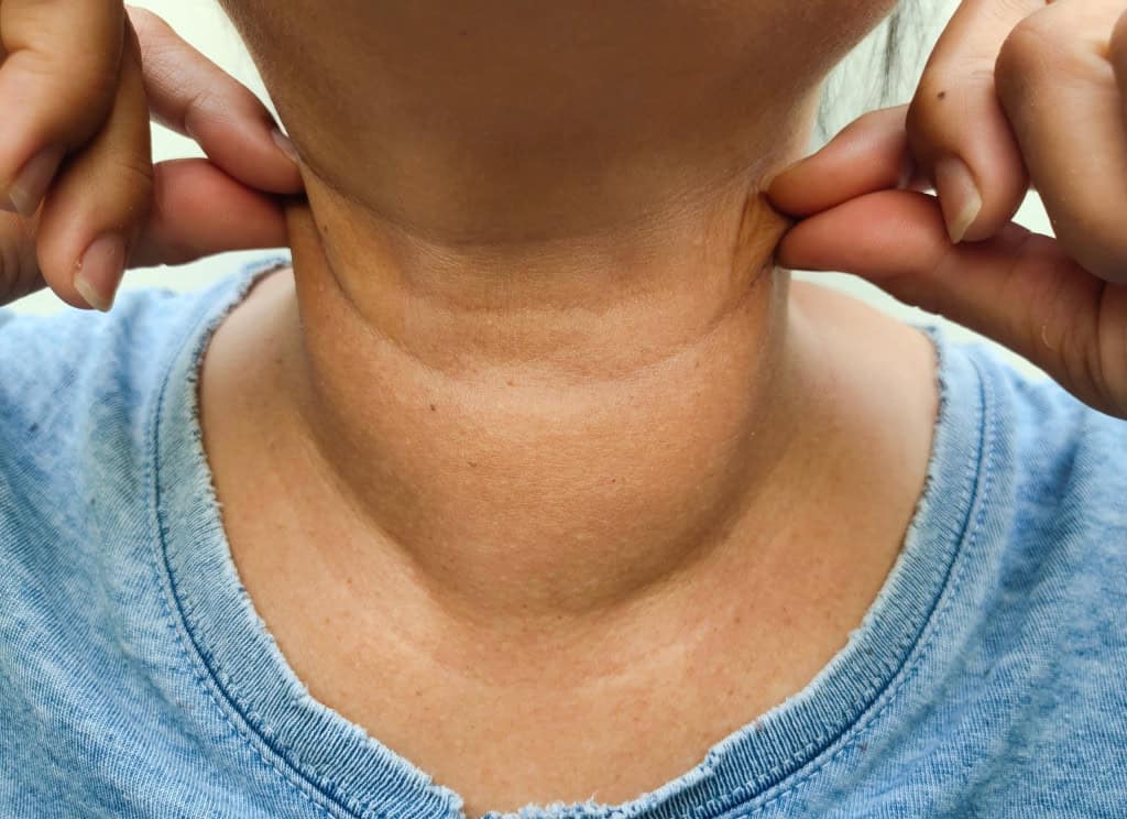 Pescoço de uma mulher com rugas