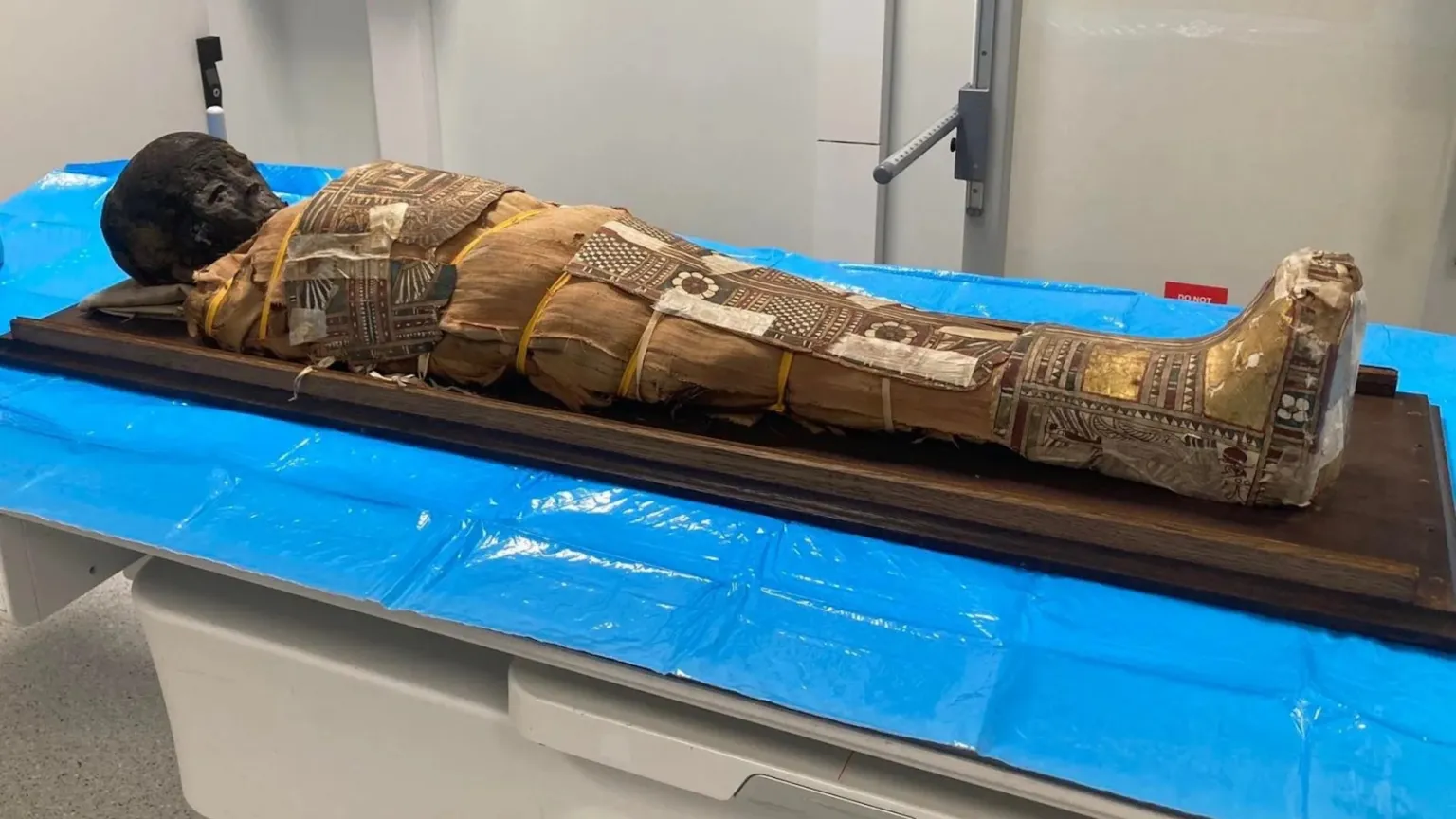 Objeto misterioso encontrado em múmia de criança egípcia