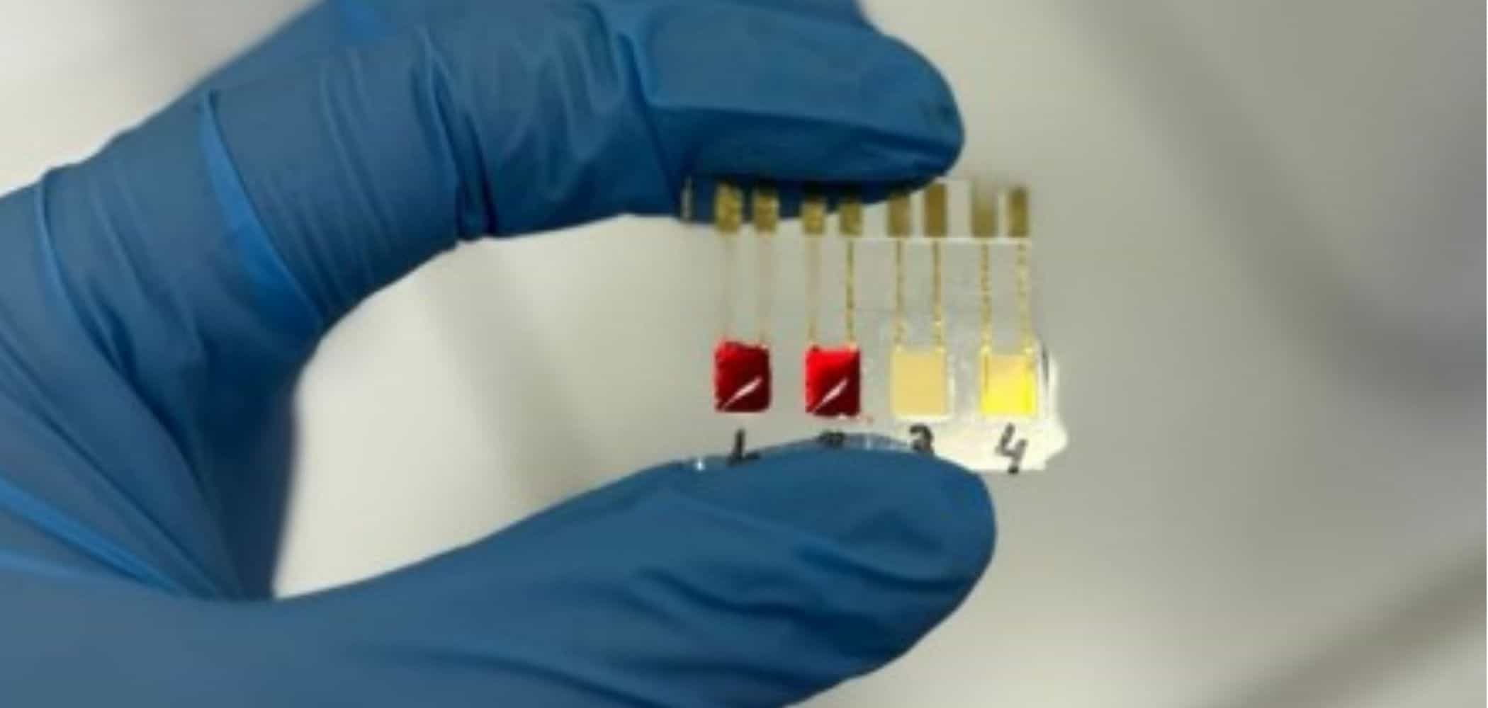 Sensor brasileiro promete detectar câncer de pâncreas em minutos