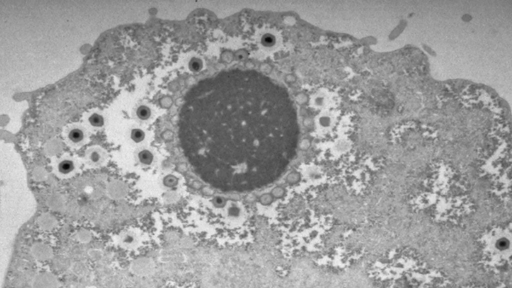 Vírus mimivírus gigantes sendo produzidos dentro da ameba Acanthamoeba castellanii