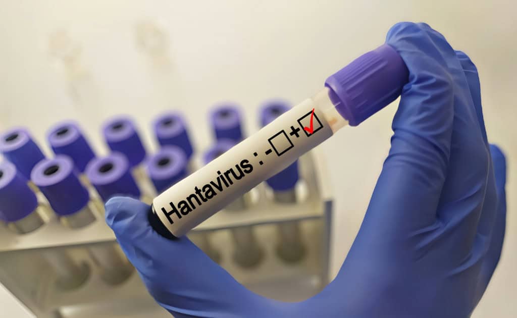 Hantavírus