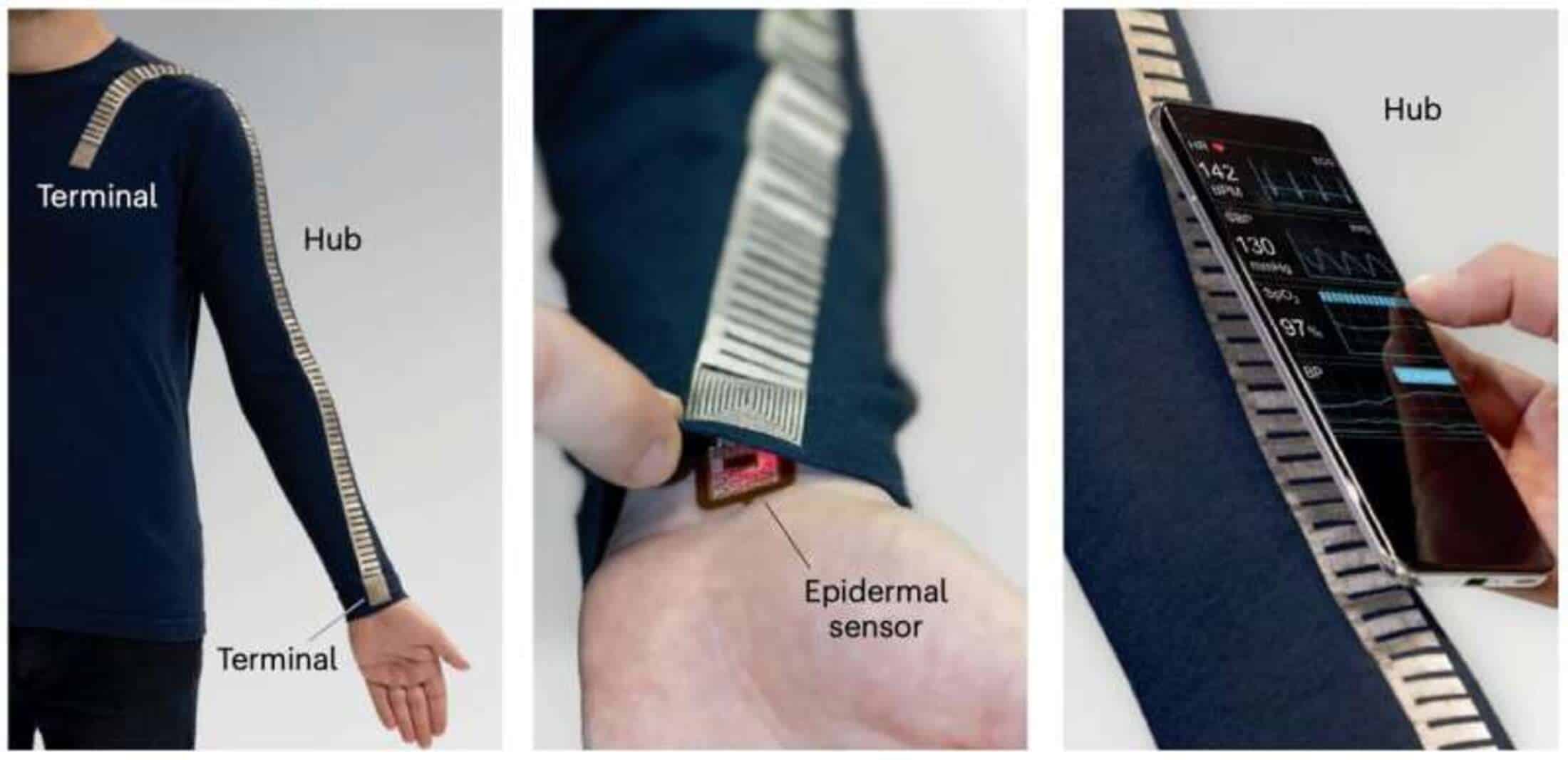 Roupa inteligente sem bateria monitora pressão arterial em tempo real