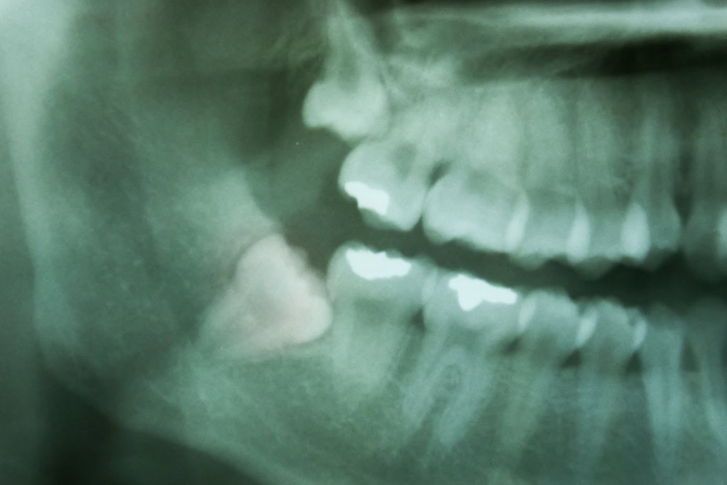 Radiografia