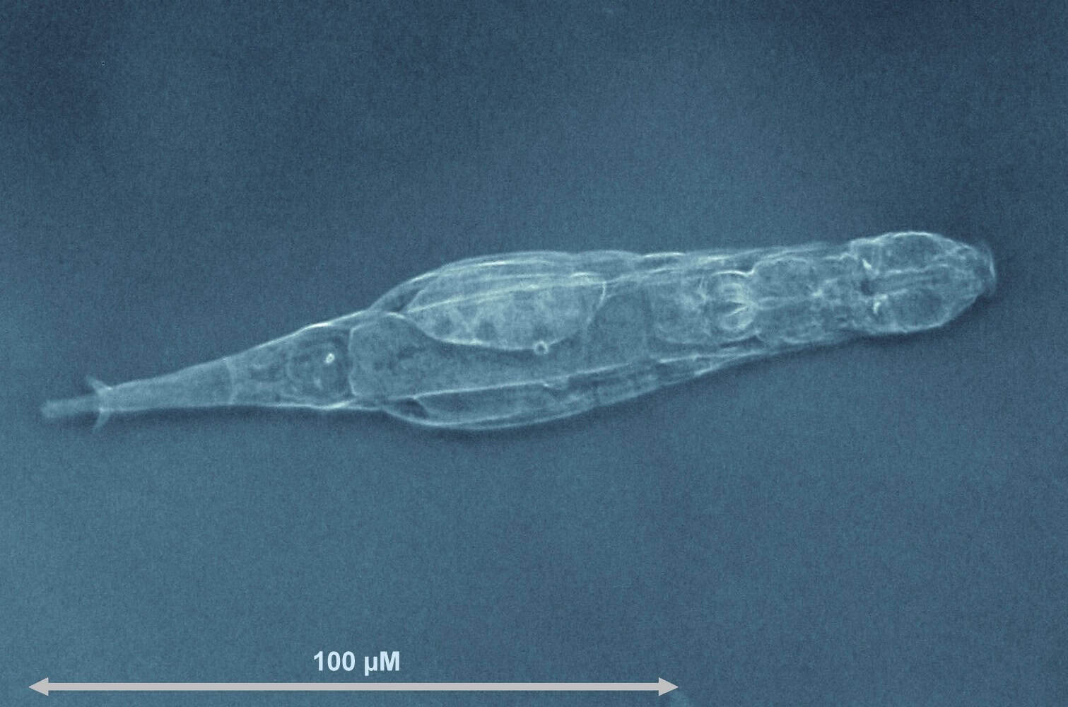 Bicho microscópico sobrevive com cromossomos quebrados e consegue reparar o DNA geração após geração
