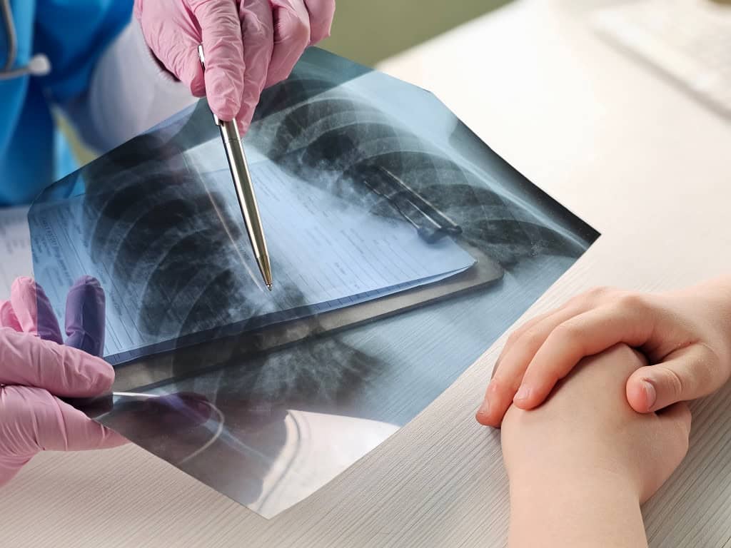 Médico explicando os resultados de radiografia de tórax durante a consulta do paciente em um ambiente de consultório médico