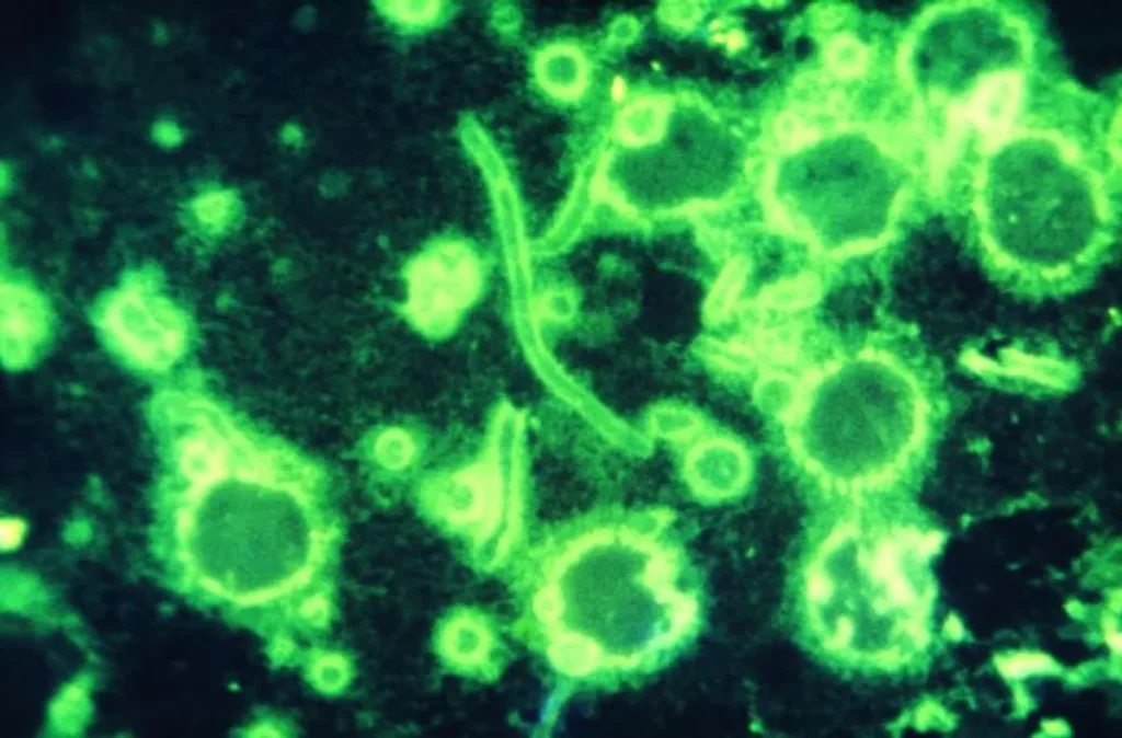 A peste pneumônica é causada pela bactéria Yersinia pestis e pode ser transmitida pelo ar. – Imagem: CDC/ Dr. M. Moody